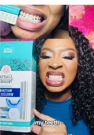 uniquebirthmark (@uniquebirthmark)