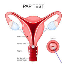 Image result for Pap Smear