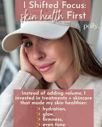 ✨ Why I Stopped Having Filler & Started Focusing