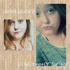 Allison's Transplant