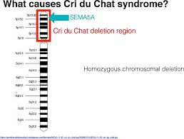 Sema5a Cri Du Chat Syndrome Pdf Free Download