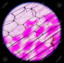 Students know the nucleus is the repository for genetic information in plant and animal cells.: Pink Plant Cells Under Microscope 400x Stock Photo Picture And Royalty Free Image Image 43886014