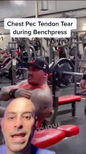 Bench Press Fail: Dumbbell Injury During Max Lifts