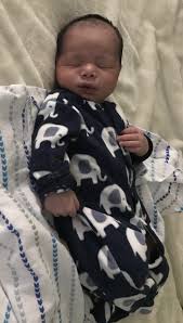 Hair loss in the first six months of life is normal for babies. Baby S Hair Falling Out Pics September 2018 Babies Forums What To Expect