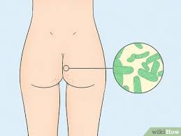 Emuaid.com has been visited by 100k+ users in the past month 7 Ways To Get Rid Of Acne On The Buttocks Wikihow