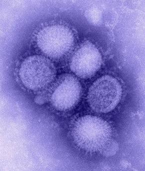H1N1 influenza A virus, AI generated