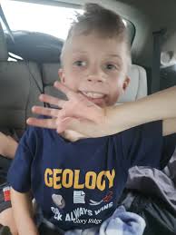 Update: Kenny G's is out of surgery!! Did done more cleaning & a little of  arthritis. In recovery and doing good. Keep praying!!