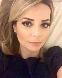 Cover de Sandy faz harmonização facial para ficar mais parecida com a  cantora - 12082019 - UOL Entretenimento