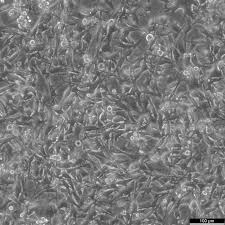 SK-MEL-2 Cells