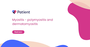 Image result for Polymyositis