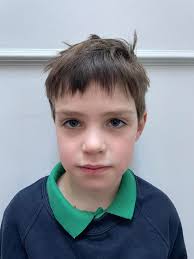 When kids with ASD/ADHD swallow lost teeth, what happens?