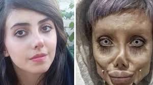 قبل إجراء اى عملية جراحية من عمليات التجميل في تركيا يتوجب على المريض التفكير جيداً فى المركز الذى سيقوم بإجراء العملية فيه، والطبيب الذى سيُجرى العملية ؛ لان العمليات الجراحية محفوفة بالمخاطر ولابد للمريض أن يكون على دراية تامة بالعمليات الجراحية. ØªØ­Øª Ø§Ù„Ø¶ØºØ· Ø§Ù„Ù‡Ø§Ø¦Ù„ Ø¥ÙŠØ±Ø§Ù† ØªØ·Ù„Ù‚ Ø³Ø±Ø§Ø­ Ø²ÙˆÙ…Ø¨ÙŠ Ø£Ù†Ø¬Ù„ÙŠÙ†Ø§ Ø¬ÙˆÙ„ÙŠ Ø¨ÙƒÙØ§Ù„Ø©