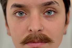 SFX3Prothèses Transferts