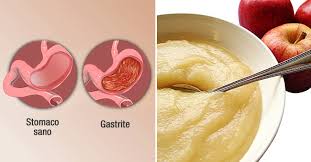 L'eccesso degli acidi nell'organismo umano possiede un'azione aggressiva, abrasiva e corrosiva sui tessuti organici. I 7 Alimenti Piu Efficaci Per Alleviare Gastrite E Acidita Velocemente Rimedio Naturale