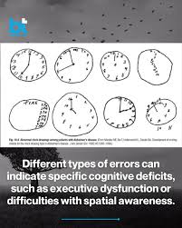 Image result for Clock Drawing Test