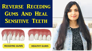Brush your teeth twice a day. Grow Back Receding Gums And Treat Treat Bleeding Gums Heal Sensitive Teeth Gingivitis Youtube