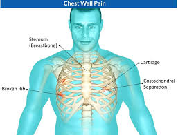 Pin On Chest Pain