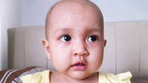 Bercak merah mirip bunga mawar ini sama sekali tak membuat indah kulit bayi. Demam Dan Bintik Merah Tak Selamanya Demam Berdarah Dbd Kumparan Com