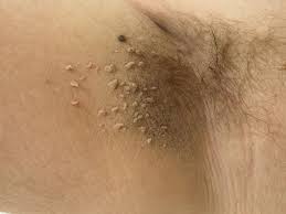 Fibrom Wiktionary