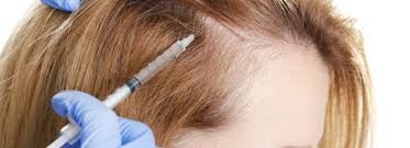 Cosmetic options for hair loss. Best Hair Loss Treatments Of 2018 Hair Transplant Dubai