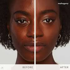 New Blog Post! "Dr. Daniel Gouws brings nearly 20 years of expertise in  cosmetic injections, proudly holding the title of Diplomat of the American  Academy of Aesthetic Medicine. As a dedicated medical