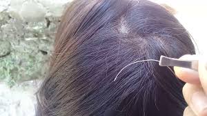 Let us find the exact reasons. Pulling Out A White Hair From Your Head Causes More Asianbeautyhub