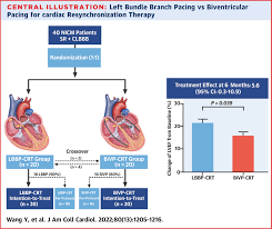 Randomized Trial of Left Bundle Branch vs Biventricular Pacing for Cardiac  Resynchronization Therapy | JACC