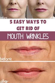 5 Ways To Get Rid Of Wrinkles Around The Mouth Mouth Wrinkles Sagging Skin Facial Oil