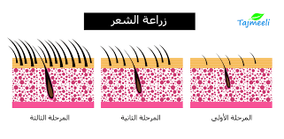 زراعة الشعر في الرياض التكلفة والأطباء والعيادات تجميلي