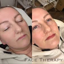 Face Therapy