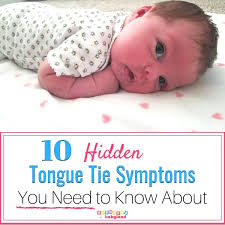Babies with anterior tongue ties cannot move their tongue forward over their gums. 10 Hidden Tongue Tie Symptoms You Need To Know About Blunders In Babyland