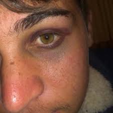 nicolas real medina (RealMedina@)