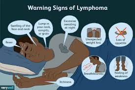 Instead of having a tumor in one organ growing larger and larger, and then spreading to other tissues, in leukemia cancer starts in the stem cells that will ultimately become blood cells. Blood Cancer And Its Initial Symptoms