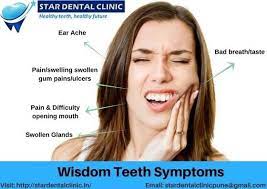 Looking For A Wisdom Teeth Removal In Pimple Saudagar Star Dental Clinic Provides Expert Dental Treatment A Wisdom Teeth Wisdom Teeth Removal Dental Treatment