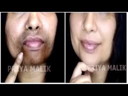 Here, we explain how to get rid of them and tips on keeping pimples from chin acne: Remove Dark Black Patches Dark Spots Around Your Mouth Get Rid Of Hyper Pigmentation Priya Malik Youtube Hyperpigmentation Black Patch How To Remove