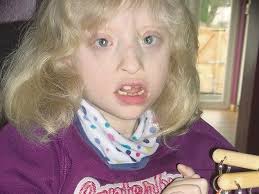 Parents in plea to help Natasha Falls take first steps