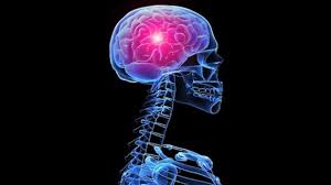 Unele persoane pot avea doar o intrerupere temporara a circulatiei sangelui in directia. Accidentul Vascular Cerebral Sever Rmn Diagnostica