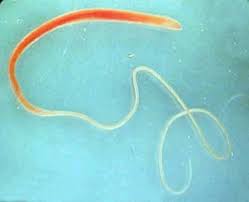 Image result for Whipworm