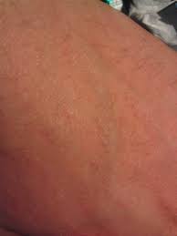 El Ustunde Kasinti Ve Minik Noktalar Resimli