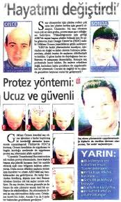 Protez Sac Merkezi Basinda Hdc Sac Merkez Hayat