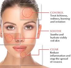 ▷how to find hospital near me. Vlcc Wellness Kalyan Mumbai Dermatology Hospital In Mumbai Lybrate Dermatology Skin Specialist Natural Rosacea Treatment