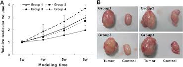 Testicular cancer is cancer that develops in the testicles, which are part of a man's reproductive system. Increased Efficiency Of Testicular Tumor Chemotherapy By Ultrasound Microbubble Mediated Targeted Transfection Of Simdr1