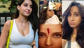 Nora Fatehi gets permanent scar on face; actress bleeds from her head;  check picture
