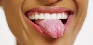 De obicei, membrana albă va ieși cu ușurință. Limba Crapata Cauze Si Tratament Sfaturimedicale Ro