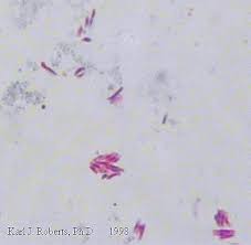 19 Acid Fast Stain Biology Libretexts