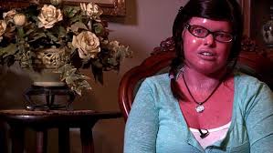 2 watchers629 page views5 deviations. Harlequin Ichthyosis Sufferer Says People Ask Me If I Ve Been In A Fire Daily Mail Online