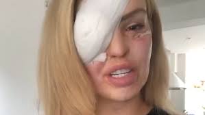 Katie Piper updates Instagram followers