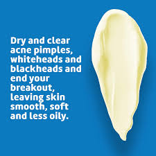 Latest covid news qld : Buy De La Cruz 10 Sulfur Ointment Acne Treatment Medication To Clear Cystic Acne Pimples And Blackheads On Face And Body Made In Usa 2 6 Oz Tube Online In Vietnam B07wp6jhqx