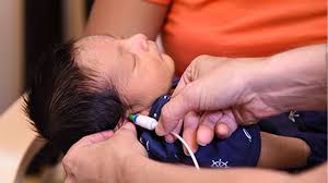 Image result for Pediatric Auditory Screening