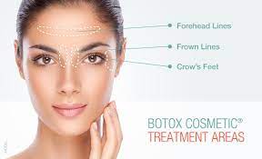 Katie lambert aging is difficult in a culture that celebrates youth. Botox Cosmetic In Port Moody Bc Dr H Ukani